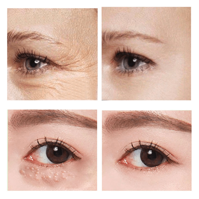 Eye Fix™ - Snel Werkende Verstevigende Oogcrème