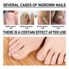 HappyNails™ - Anti Paronychia Olie