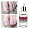 Ultrax™ - Herstel Van Schimmelnagel - 15ml