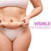 MYMI Curvebelly™ - Curve Buik Wonder Patch (1BOX)